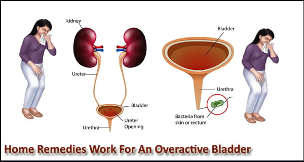 What Home Remedies Work For An Overactive Bladder